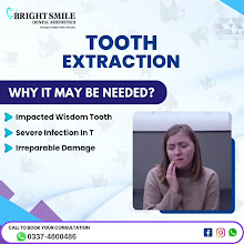 Bright Smile Dental Aesthetics educational post about tooth extraction